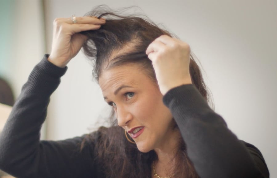 Barb-thinning-hair-temple