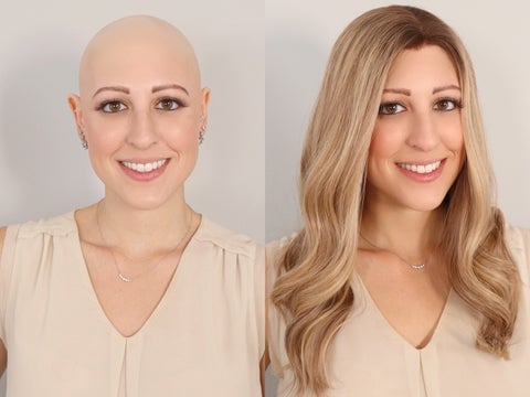 How to conceal alopecia