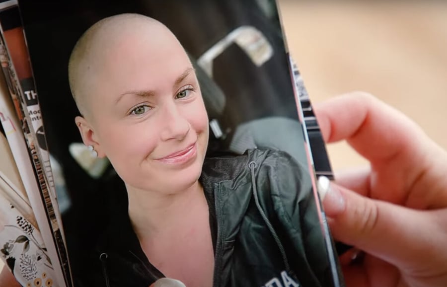 Katelyn-no-hair