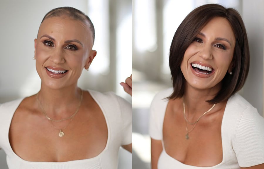 Mirna-before-after