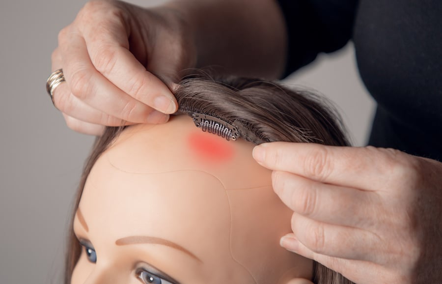 Topper-clips-causing-scalp-pain
