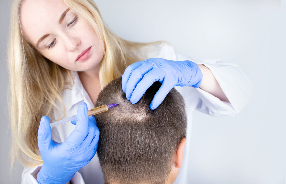 Hair Loss Treatment How to Treat Hereditary Hair Loss