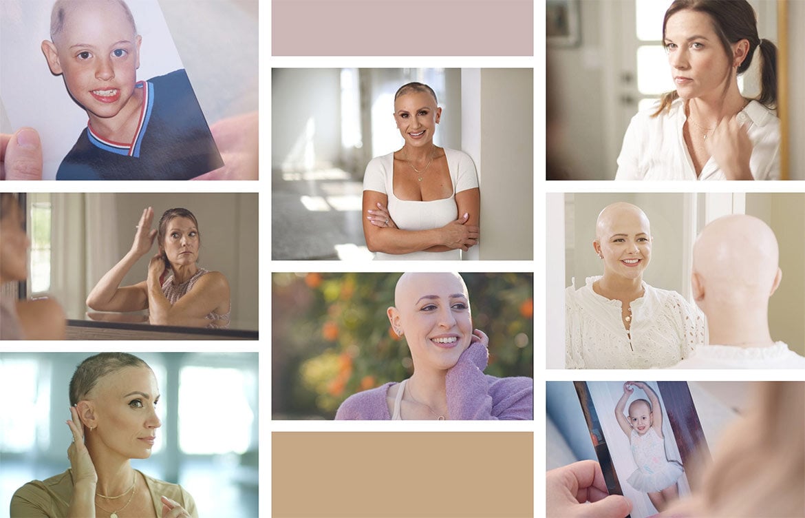 Alopecia Awareness Month - Support Guide for People with Alopecia