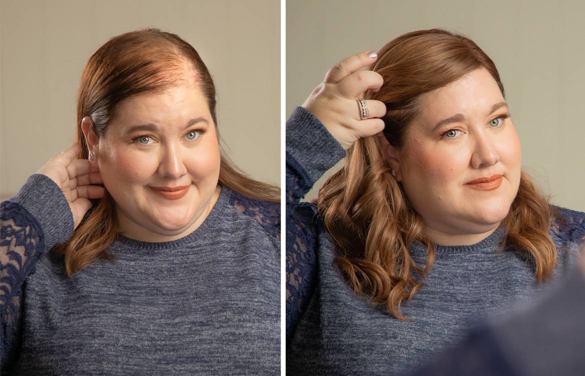 My Journey With PCOS-Related Hair Loss and Hair Toppers