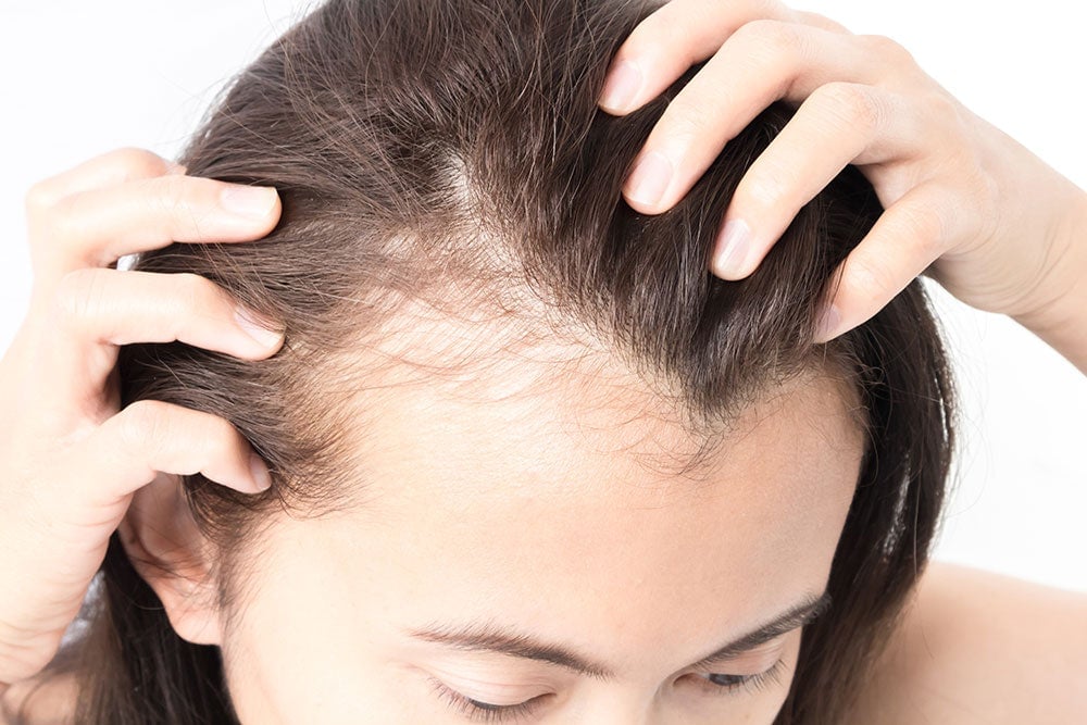 Can Traction Alopecia be Reversed? When Is It Too Late Too Late To Recover  | Daniel Alain