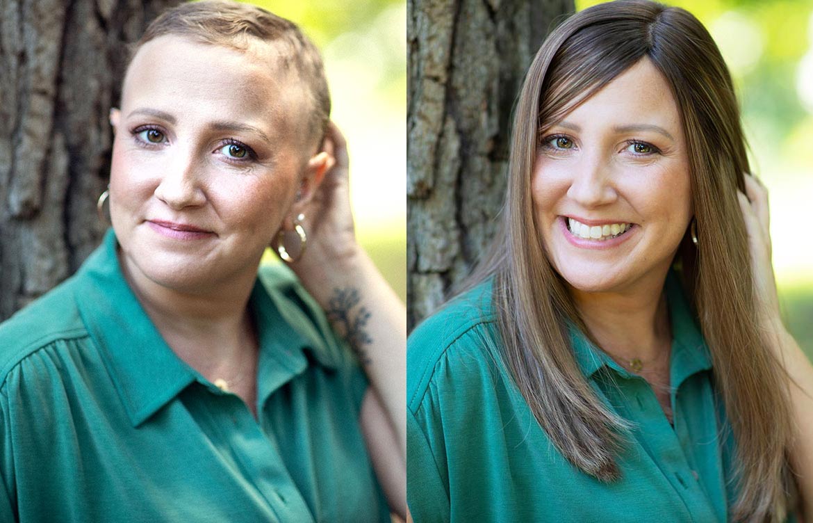 Struggling With Hair Loss? Why Follea Wigs Are a Trusted Solution