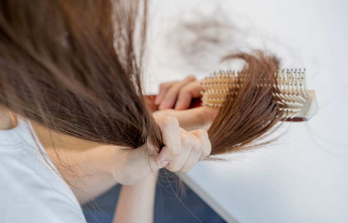 Best Treatments for COVID-Induced Hair Loss