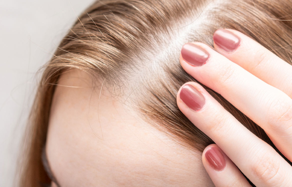 The Best Alopecia Treatments that Actually Work